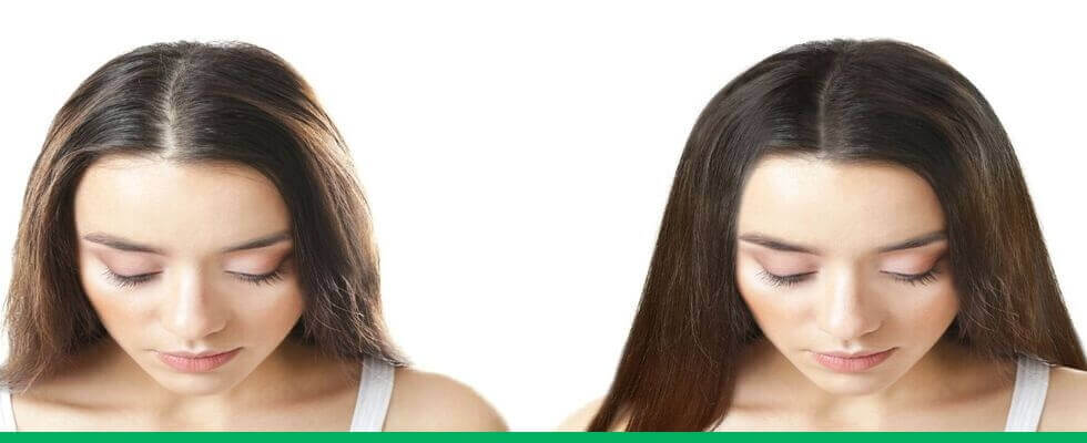 Antes e depois de cabelos finos e engrossados